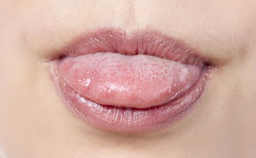 吃饭时老是咬到腮帮子和舌头，不要以为是小事，可能是这3种疾病