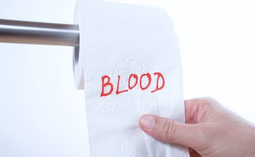 警惕！便血不一定是痔疮，也可能是这三种疾病的信号！