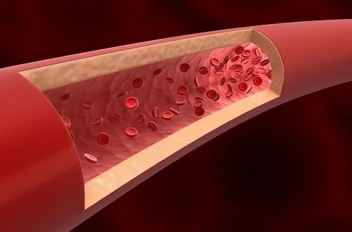 血管堵塞，三个部位或会“喊疼”！医生：吃2酸，喝3茶，对血管好