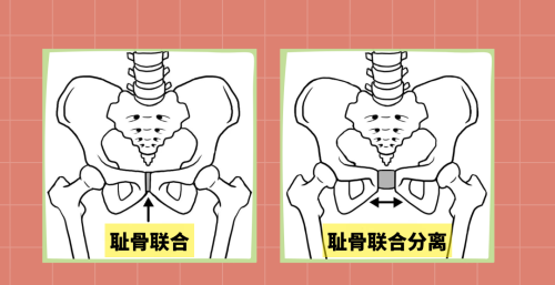 一眼就能看出是否生过娃？五张图告诉你，为啥怀孕后身材会走样