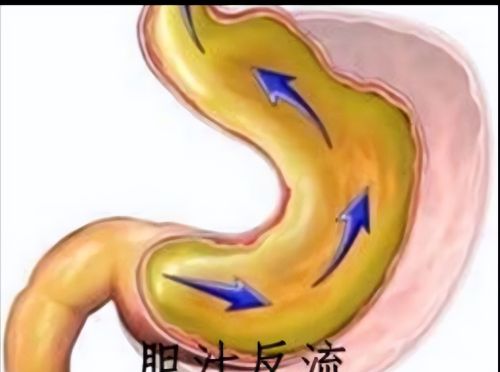 手术切除“胆囊”，会有哪些后遗症？医生说出大实话，涨知识了