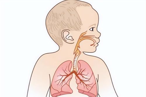 小孩得肺炎，都是什么原因引起的？