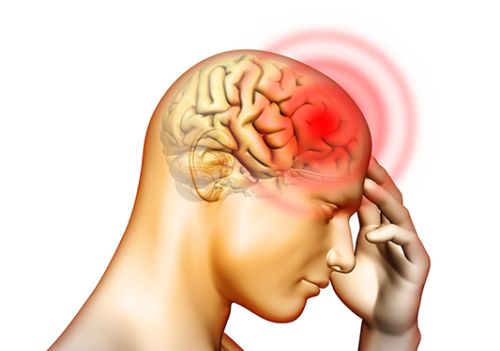 苯甲酸利扎曲普坦片是治疗偏头痛的首选药物，科学服用注意4点