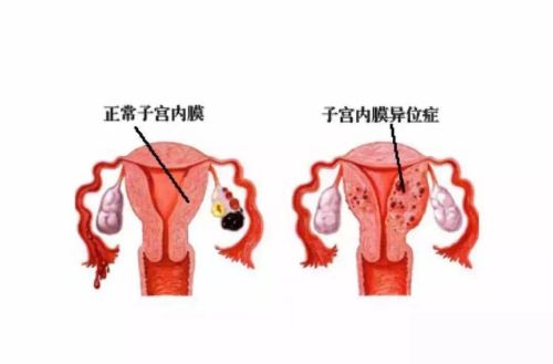 26岁女子咳血，怀疑是肺炎，医生听了丈夫一句话：快转到妇产科