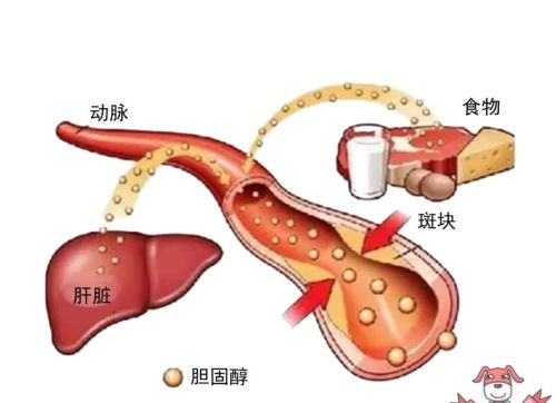 胆固醇越低越好？它的危害可比你想象中要严重