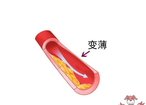 胆固醇越低越好？它的危害可比你想象中要严重