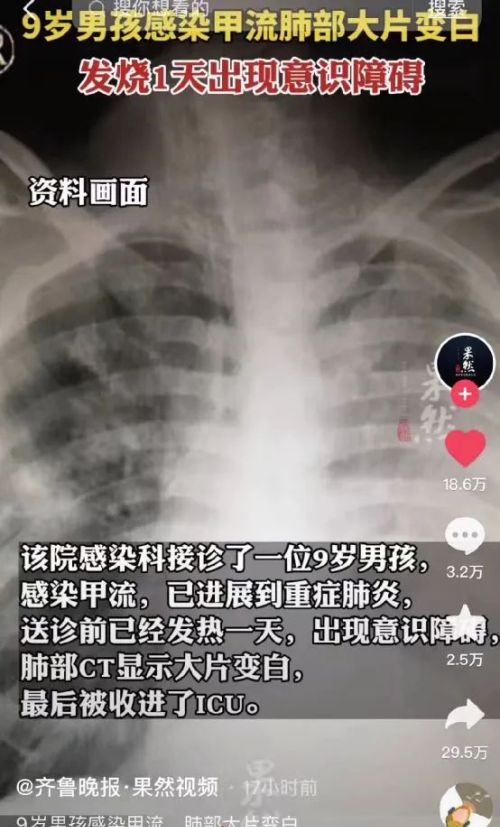 9岁男孩确诊“白肺”进ICU，咳痰有这个情况一定去医院！尤其孩子