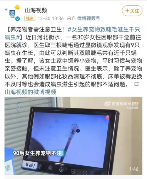 眼睛螨虫检出率100%！什么时候会导致发病？医生：4类人群要注意