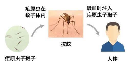 蚊子咬了忽冷忽热，是被“疟”了吗？