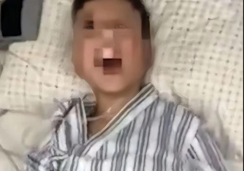 狂犬病夺走8岁生命，家长应该如何预防？