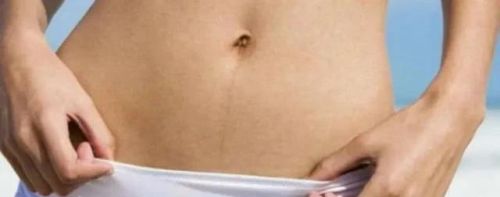 女生肚子上为什么都有一条褐色的线？