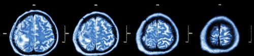 做一次CT，对身体有危害？致癌吗？医生建议：做好4点降低伤害