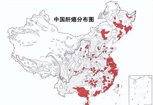 中国肝癌高发分布地图