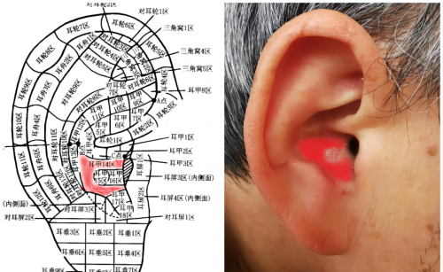 阳了不用怕，拍打这里，可大大改善不适症状！