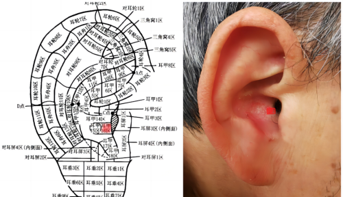 阳了不用怕，拍打这里，可大大改善不适症状！