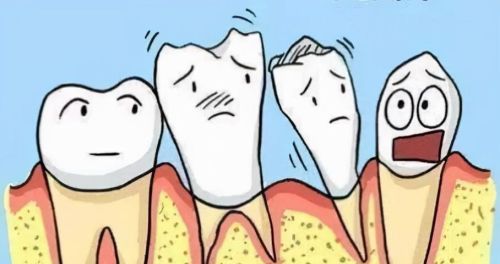 牙龈萎缩的诱发因素有哪些(牙龈萎缩的诱发因素是什么)