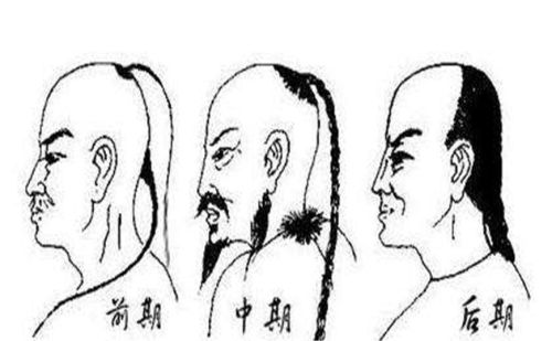清朝必须要留辫子，不留辫子的人会被直接处死，那秃顶的人咋办？