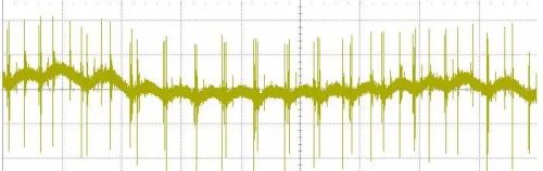 开关电源的五种纹波噪声如何抑制？跟着老鸟工程师学就对了