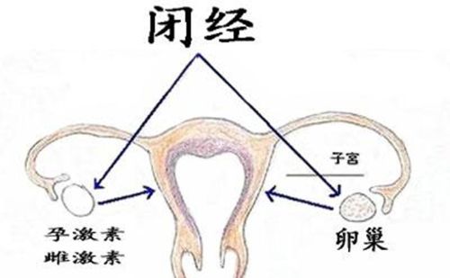 不懂就问，人还年轻，闭经了怎么办？