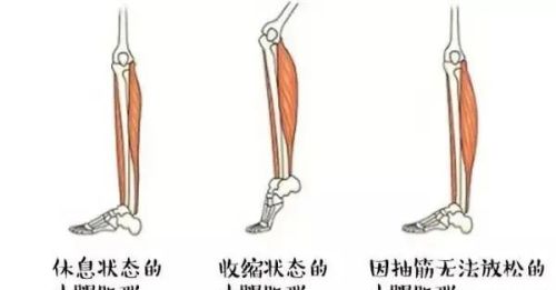 如何快速解决腿抽筋的问题？