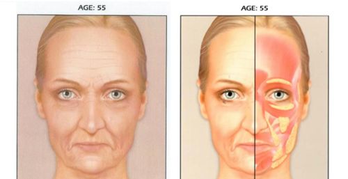 女人怎么能防止衰老？