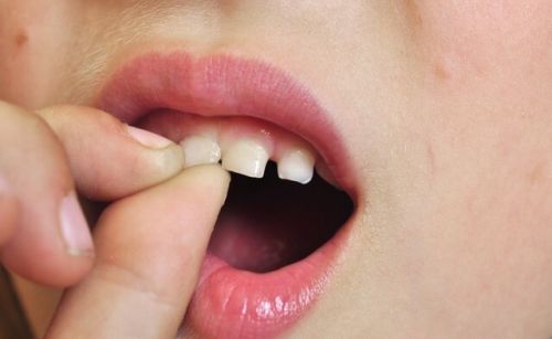 用什么方法能保住松动的牙齿？