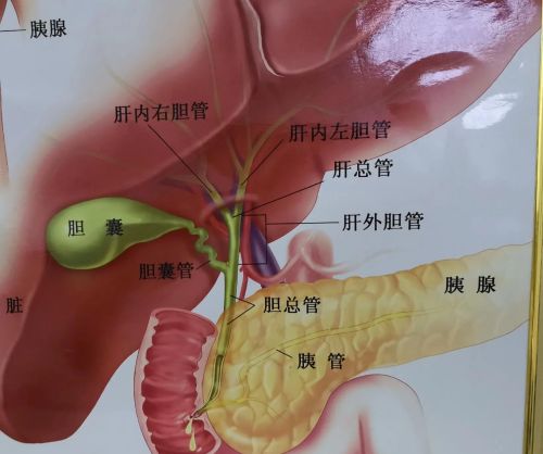 胆管结石，医生建议胆囊切除，我该怎么办？