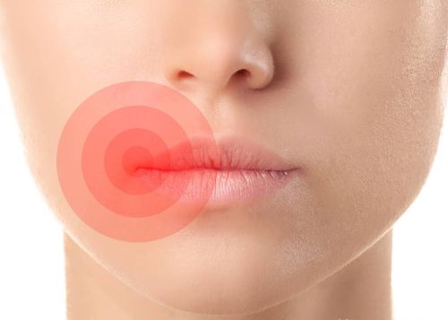 嘴唇起泡是什么原因？