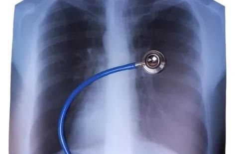凶险的大白肺是怎样形成的？