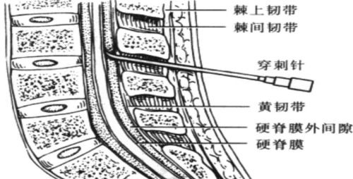 做手术的时候打了麻药之后，都会有什么感觉？