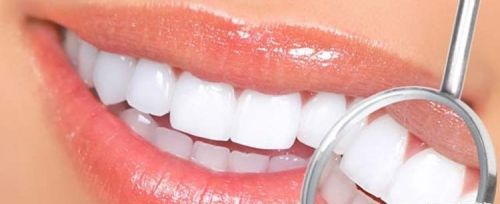 洗牙=美白牙齿吗？