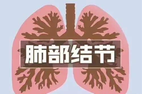 双肺多发小结节，建议定期复查是怎么回事？