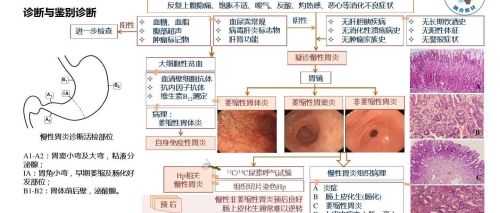 慢性胃炎为何久治不愈，什么原因？