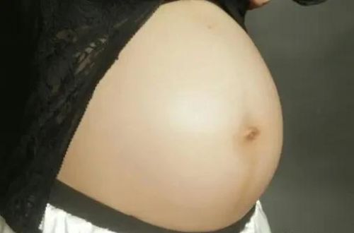 怀孕为什么肚脐会凸起？