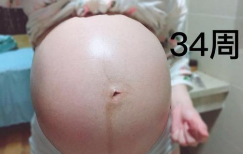 怀孕为什么肚脐会凸起？