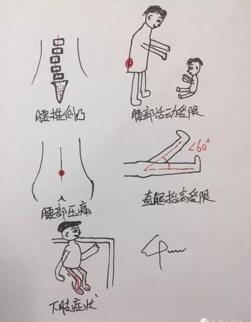 腰椎间盘突出怎么办？