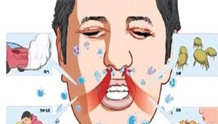 鼻窦炎吃什么药能治愈？