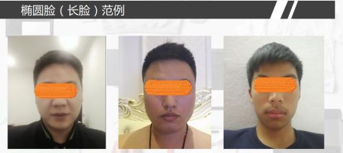 男士不同脸型都该怎么设计发型呢？