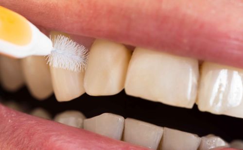 这5个坏习惯会导致牙龈萎缩，要尽量避免