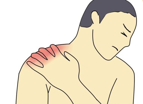 得了肩周炎吃药、按摩、贴膏药管用吗？一文详解肩周炎的治疗方法
