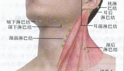 小孩颈部淋巴结肿大：是什么原因？如何治疗？医生带你了解一下