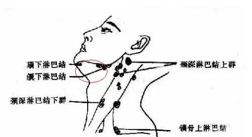 小孩颈部淋巴结肿大：是什么原因？如何治疗？医生带你了解一下