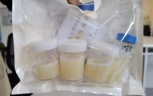 河北40岁女子“洗肺”洗出24桶“牛奶”！医生：严重或危及生命