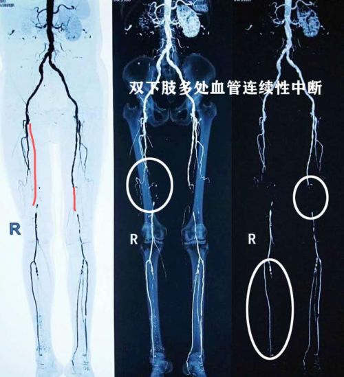 得了什么病最疼？