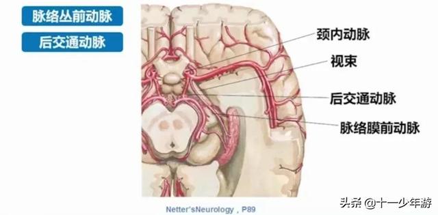 脑血管解剖结构图（概述和血管解剖）(23)