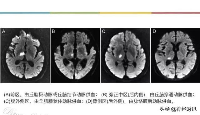 丘脑解剖结构图及功能（丘脑的解剖生理功能）(9)