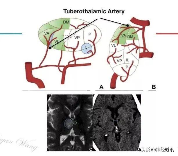 丘脑解剖结构图及功能（丘脑的解剖生理功能）(16)