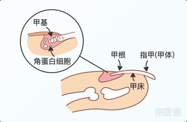 指甲边上长倒刺是什么原因（健康篇指甲上没月牙）(2)