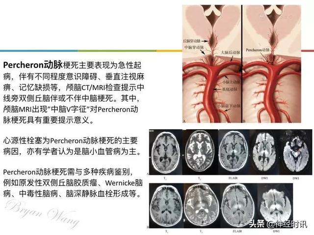 丘脑解剖结构图及功能（丘脑的解剖生理功能）(15)