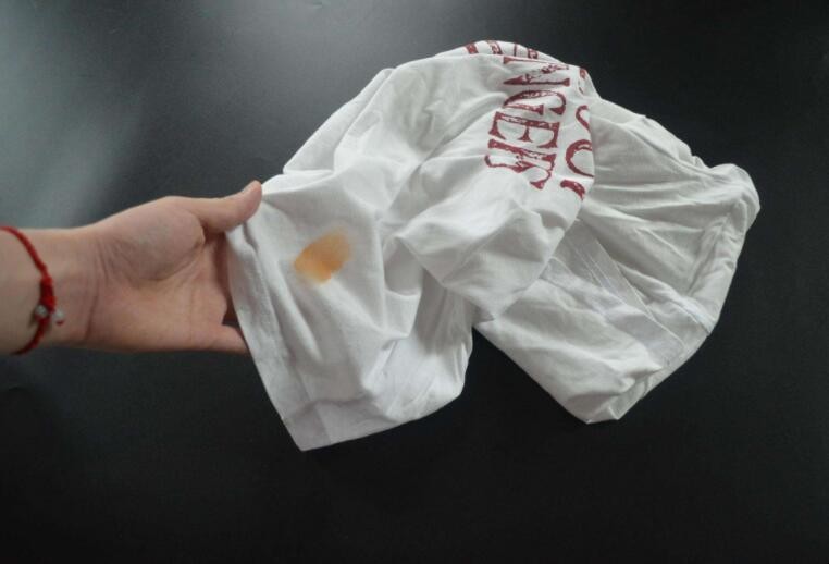 衣服油渍怎么去除